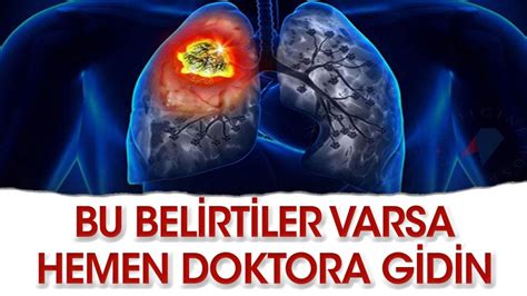 Akciğer Kanseri Belirtileri