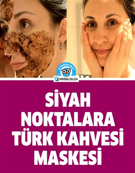 Siyah Noktalar için Cilt Maskesi Tarifi